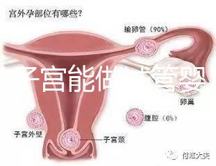 雙角子宮能做試管嬰兒嗎？可以，但這2大條件缺一不可