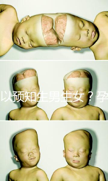 可以預(yù)知生男生女？孕婦夢(mèng)見(jiàn)馬的胎夢(mèng)解讀