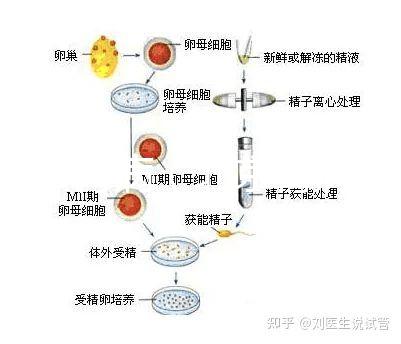 北京 腎?。ū本┠I病醫院排名第一）
