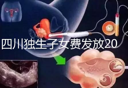 四川獨生子女費發(fā)放2024年新規(guī)定，如何盡快領(lǐng)取自貢？