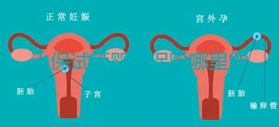 人保試管嬰兒保險哪里能買、怎么買速覽，一篇看懂不踩坑