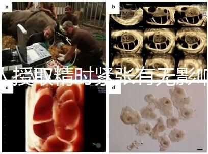 人授取精時緊張有無影響別還不造，注意事項不少不可不知