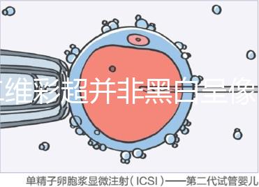 二維彩超并非黑白呈像，通過檢查還能看清胎兒五官