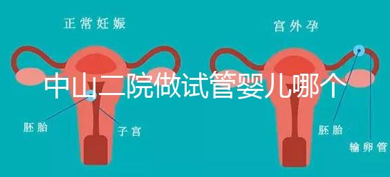 中山二院做試管嬰兒哪個醫生好？附醫院試管成功率