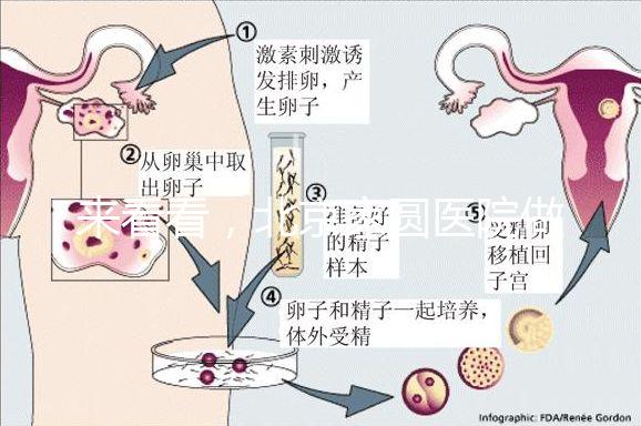 來看看，北京家圓醫(yī)院做三代試管費用總共多少？