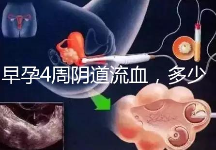 早孕4周陰道流血，多少天檢查血hcg或B超更穩(wěn)妥？