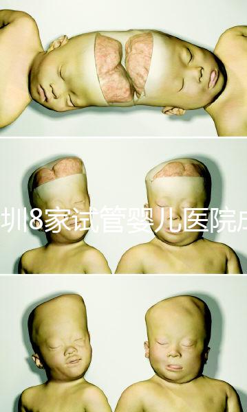 深圳8家試管嬰兒醫院成功率排名,供卵、供精首選各不同