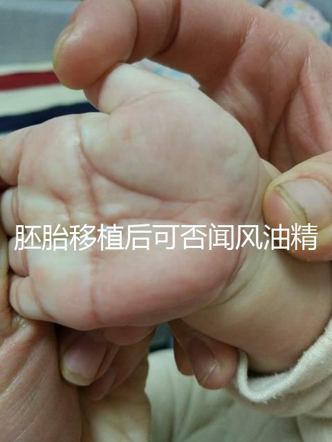 胚胎移植后可否聞風油精速覽,導致著床失敗真不是鬧著玩