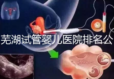 蕪湖試管嬰兒醫院排名公開，弋磯山醫院、蕪湖二院獲好評