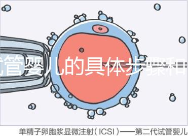 試管嬰兒的具體步驟和(做試管的流程順序)