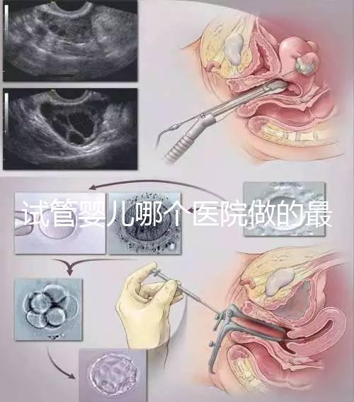 試管嬰兒哪個醫院做的最好呢？多家權威機構推薦