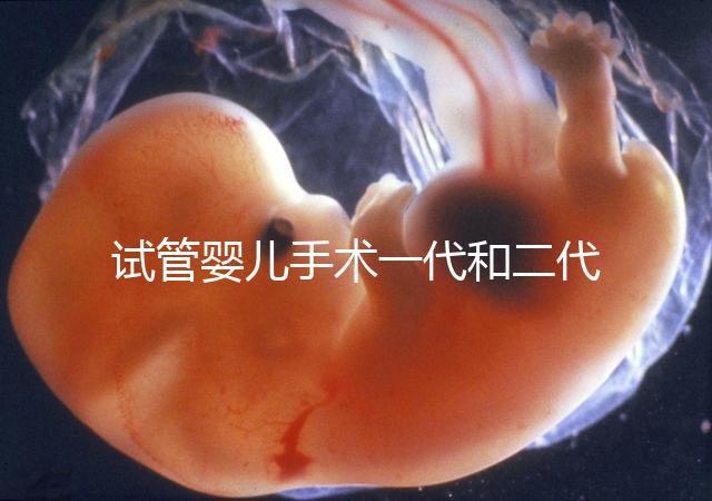 試管嬰兒手術(shù)一代和二代有哪些區(qū)別?