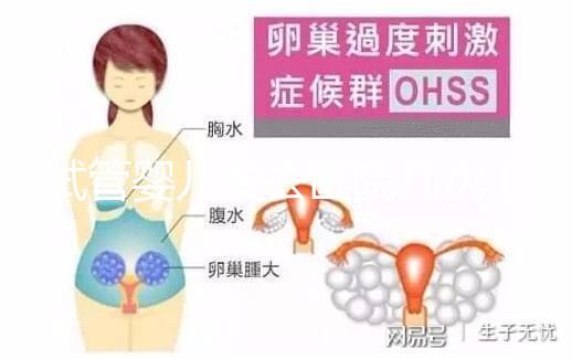 試管嬰兒要去醫院幾次(試管嬰兒要去醫院幾次?)