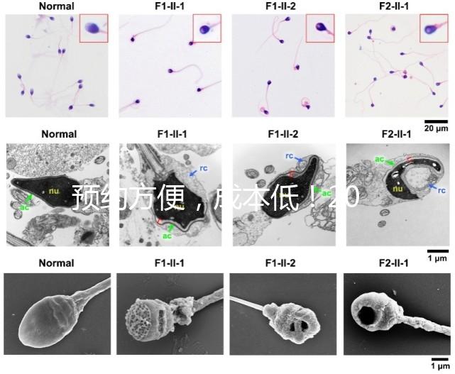 預(yù)約方便,成本低!2024年西安新城、臨潼、雁塔四維彩超指南
