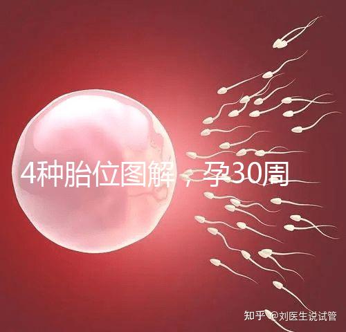 4種胎位圖解，孕30周這個姿勢最適合順產