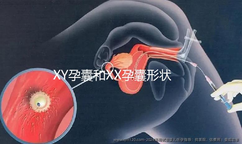 XY孕囊和XX孕囊形狀各有差異，橢圓形可能是懷女哦！