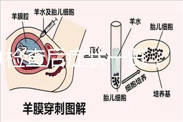 tct檢查后癥狀一覽，專家提醒做好處理措施是關鍵
