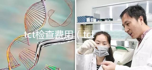 tct檢查費(fèi)用（tct檢查一般多少錢）